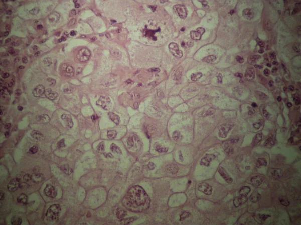 Choosing the Right Gastroenterologist: Tips for Better Health Care